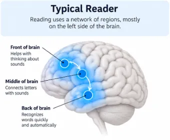 Diagram of a typical reader's brain: reading uses a network of regions mostly on the left side, for sound, letter-sound connections, and quick word recognition